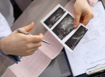 Doctor compares cardiogram, ultrasound diagnosis. Doctor determines amount additional diagnosis needed. Cardiologist analyzes results studies. Assessment dynamics condition and final diagnosis.